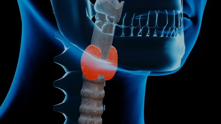 Iodine Thyroid